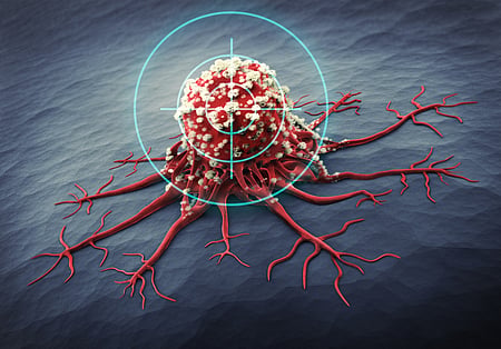 Cancer should be declared a notifiable disease: Supreme Court directs 19 states